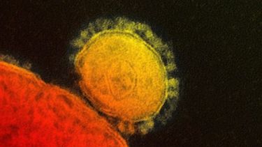 El Instituto de la Alergia y Enfermedades Infecciosas  muestra en la imagen la transmisión del coronavirus (Foto:AP)