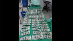 Los cirujanos encontraron el dinero y lograron extraer 5.700 dólares en billetes de 100 dólares.