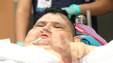 El mexicano Juan Pedro Franco, considerado el hombre más obeso del mundo, fue sometido este martes 9 de mayo a una cirugía que redujo su estómago, en un hospital de la occidental ciudad de Guadalajara, capital del estado mexicano de Jalisco. &nbsp;