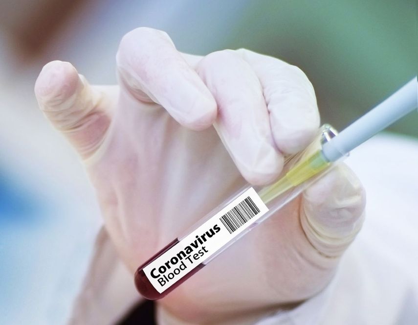 Varias farmacéuticas trabajan en la creación de vacunas contra el COVID-19.