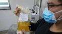 El doctor Zhou Min, un paciente recuperado del COVID-19, dona plasma en el banco de sangre en Wuhan, China. El doctor Zhou Min, un paciente recuperado del COVID-19, dona plasma en el banco de sangre en Wuhan, China.