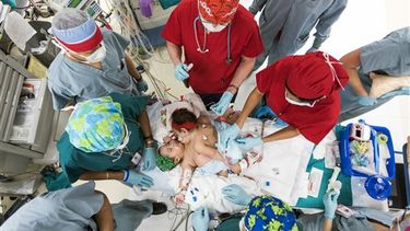 Un equipo de médicos se prepara para separar a las siamesas Knatalyne Hope Mata y Adeline Faith en el Hospital Infantil de Texas en Houston. AP