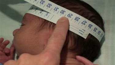 Análisis científicos han confirmado que la cepa del virus zika que afecta a Brasil es responsable de los casos de microcefalia en el sureño país (Cortesía)