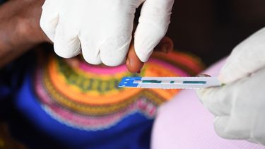 12 millones de pacientes de VIH no reciben tratamiento según OMS