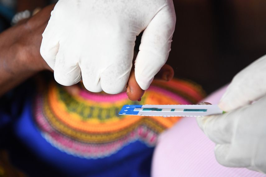 12 millones de pacientes de VIH no reciben tratamiento según OMS