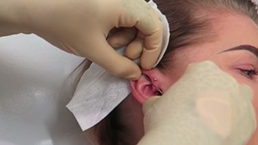 ¿un piercing que alivia el dolor de cabeza?
