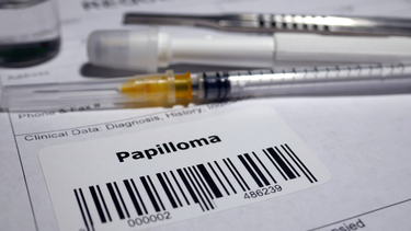 Indemnizan a mujer que contrajo papiloma en auto de su pareja