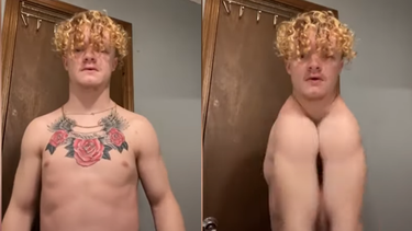 Nace sin clavícula y quiere crear conciencia