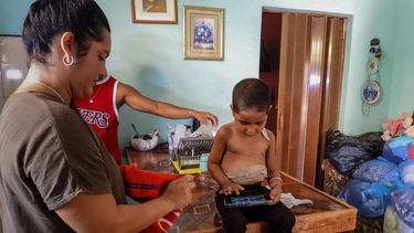 Jessica Rodríguez Romero viste a su hijo, Luis Angelo, después de completar una sesión de alimentación necesaria debido a su traqueotomía, en su casa en el barrio de Santa Fe de La Habana, el 2 de julio de 2025.