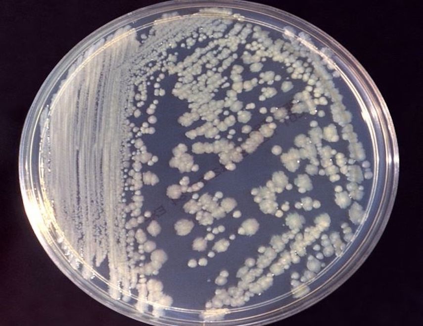 Cepas de Enterobacter, bacterias similares a organismos infecciosos oportunistas descubiertos en hospitales, se han identificado en la Estación Espacial Internacional.