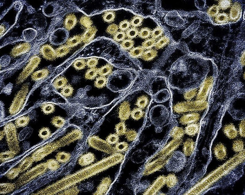 Micrografía del virus de influenza aviar altamente patógena.