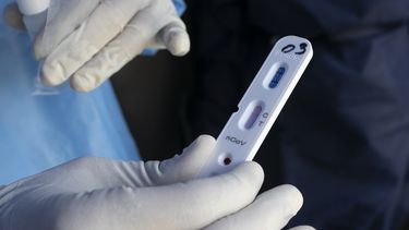 Un médico muestra una prueba rápida de coronavirus que dio negativo en una carpa montada en la entrada de un hospital en Caracas, Venezuela, el miércoles 15 de abril de 2020