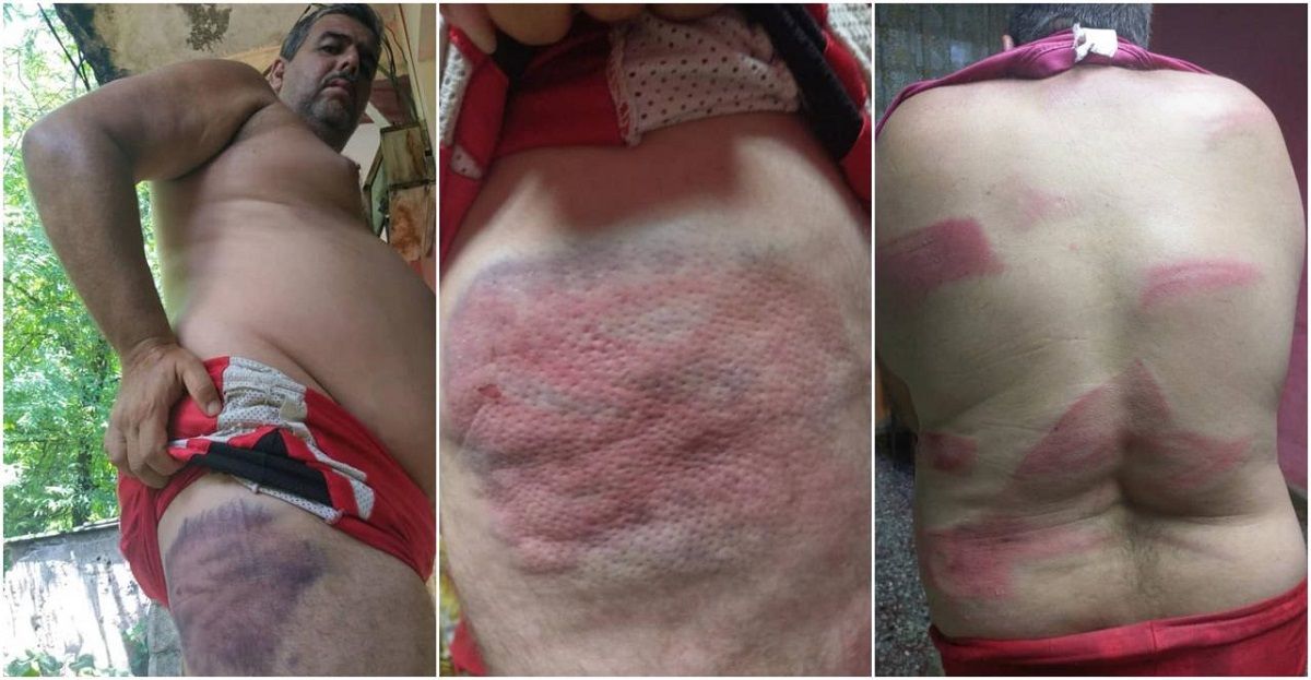 Agentes propinan brutal golpiza con bate a opositor cubano Agentes propinan brutal golpiza con bate a opositor cubano
