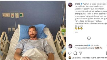 El delantero del Puebla sufrió las fracturas el pasado viernes en el compromiso contra el Queretaro por la séptima fecha de la Liga Mx y este domingo fue operado