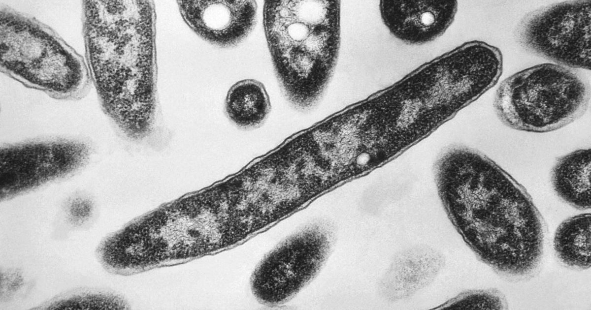 Śmiercionośna bakteria rozprzestrzeniła się na granicy polsko-ukraińskiej