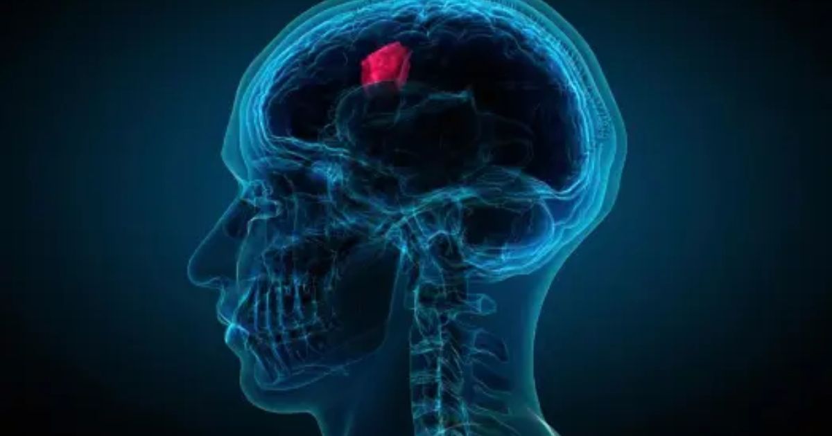 Investigan casos de cinco enfermeras de hospital de Massachusetts que desarrollaron tumores cerebrales