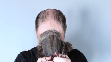 ¡la solucion para la calvicie!