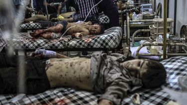 Un niño sirio recibe los primeros auxilios en un hospital de campaña luego de que se registrara un ataque aéreo llevado a cabo presuntamente por fuerzas leales al gobierno sirio en la ciudad controlada por los rebeldes de Douma, en las afueras de Damas