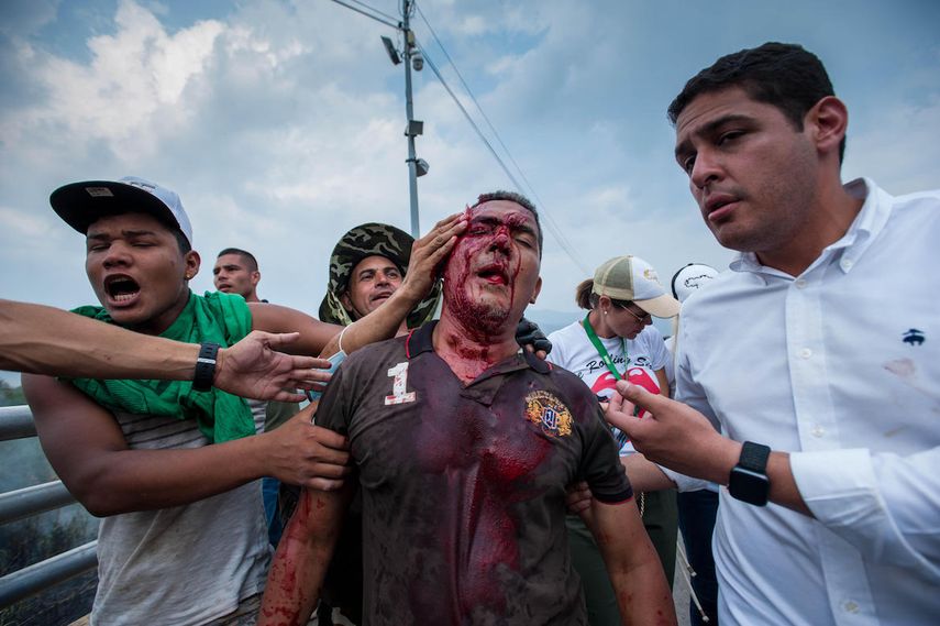 Uno de los heridos es trasladado por el diputado &nbsp;venezolano y también médico José Manuel Olivares.