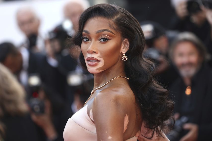 La modelo canadiense Winnie Harlow posa al llegar al estreno de Elvis en el Festival de Cine de Cannes.
