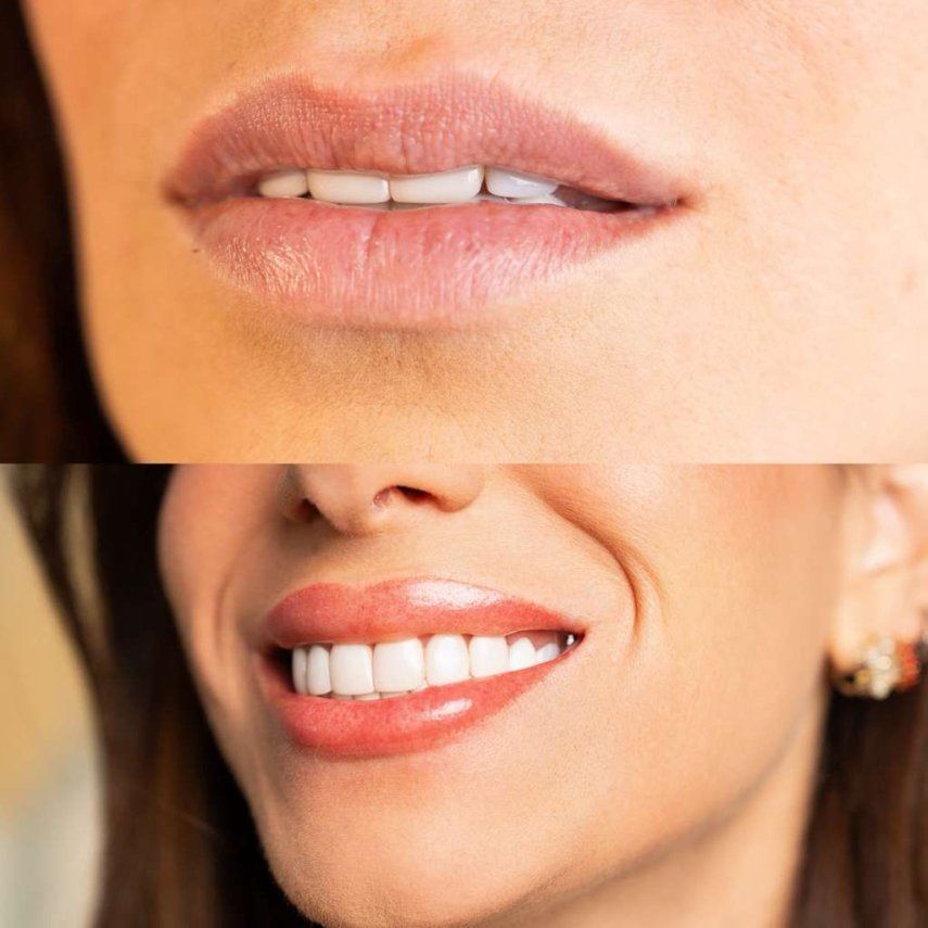 Antes y después del lip blush.