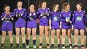 Jugadoras de club francés juegan con las piernas desnudas como protesta Jugadoras de club francés juegan con las piernas desnudas como protesta