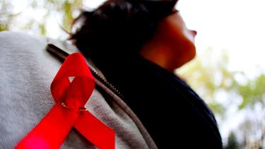 Los pacientes de VIH no deberían ser tratados diferente.