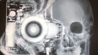 Sólo unos pocos descubrimientos han influenciado tanto la medicina, la tecnología y la ciencia como los rayos X. (Archivo)