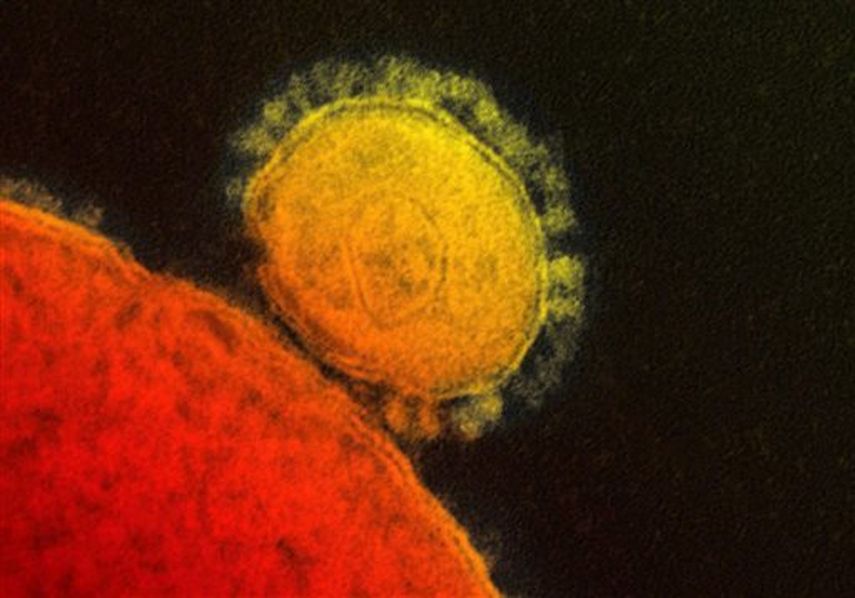 El Instituto de la Alergia y Enfermedades Infecciosas  muestra en la imagen la transmisión del coronavirus (Foto:AP)