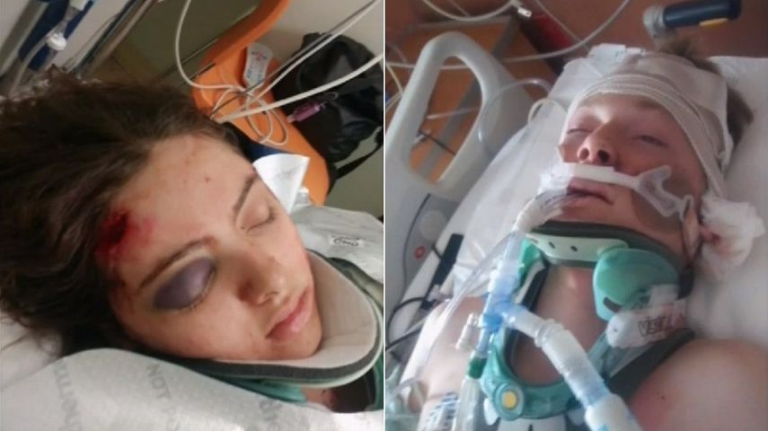 Isabela Perdomo, de 15 años, y James Critz, de 16, permanecen hospitalizados en el Memorial Regional Hospital, al norte de Miami.&nbsp;