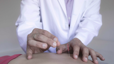 La acupuntura es utilizada para diferentes fines, desde tratamientos médicos hasta balances emocionales.