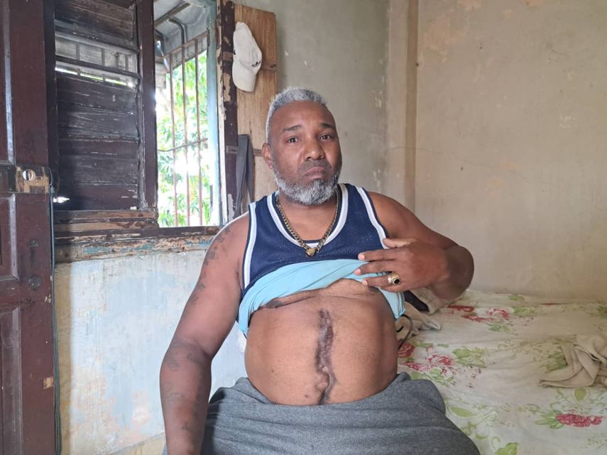 Osiris José Puerto Terry, 49 años, trabajador por cuenta propia baleado en manifestación en Cuba.