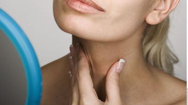 El hipotiroidismo es considerado una enfermedad autoinmune.&nbsp;