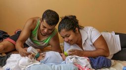 Los siameses Ezequiel y Samuel fueron separados con éxito tras una cirugía que duró más de 18 horas y que constituye un acontecimiento histórico en la salud en Costa Rica.