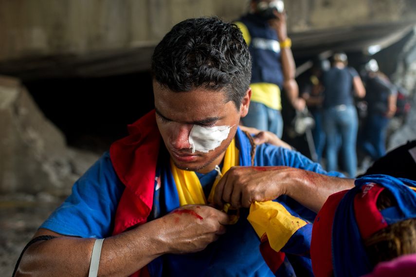 Vista de un manifestante que resultó herido durante una manifestación de opositores.