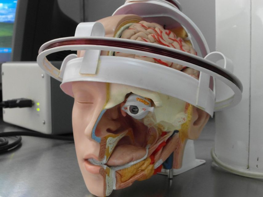 Modelo para ubicar lesiones cerebrales.(Archivo)