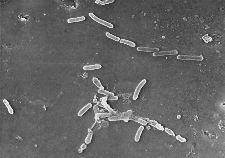 Imagen de microscopio electrónico proporcionada por los Centros para el Control y la Prevención de Enfermedades de Estados Unidos (CDC, por sus siglas en inglés) que muestra la bacteria Pseudomonas aeruginosa en forma de bastón.&nbsp;