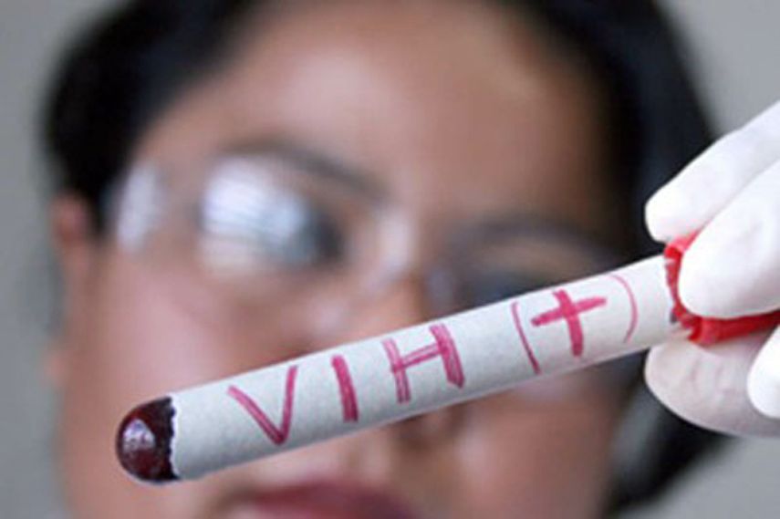 El organismo internacional contabilizó en 2015 que en América Latina había 2 millones de personas con VIH, 100.000 nuevos contagios en adultos y 2.100 nuevas infecciones en niños.