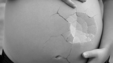 Imagen referencial al aborto