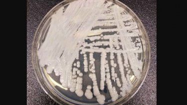 Esta foto sin fecha proporcionada por los Centros para el Control y la Prevención de Enfermedades muestra una cepa de Candida auris cultivada en una placa de Petri. &nbsp;