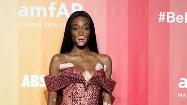 Winnie Harlow, modelo canadiense y portavoz de la condición de la piel llamada vitiligo, acude a la gala benéfica de&nbsp;la fundación&nbsp;amfAR, con el fin de recaudar fondos para la lucha contra el sida.