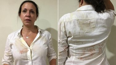 La dirigente opositora venezolana María Corina Machado muestra las secuelas del ataque chavista.