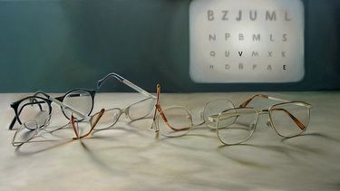 Existe la tendencia&nbsp; de los altos miopes a sufrir degeneración macular, un problema que, al parecer, está emergiendo como causa líder de ceguera en Asia y diversos países industrializados.