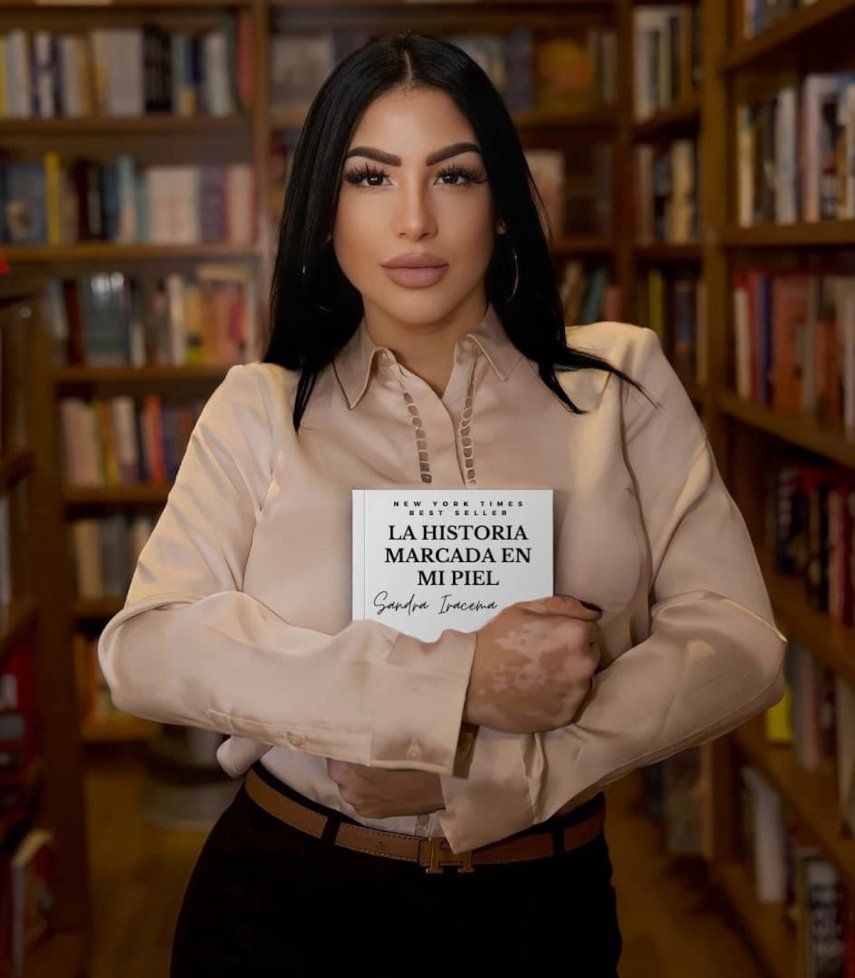 La empresaria e influencer cubana Sandra Iracema posa con su libro, La historia marcada en mi piel.