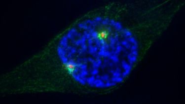 Imagen microscópica de una célula humana durante su división.