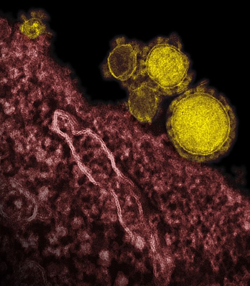 Imagen de microscopio electrónico proporcionada por el Instituto Nacional de Enfermedades Alérgicas e Infecciosas muestra en amarillo partículas de coronavirus, también conocido como virus MERS. (Foto AP/NIAID, archivo)