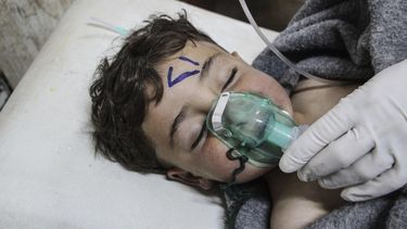 Un niño recibe tratamiento médico tras un supuesto ataque químico contra la localidad de Jan Shijún, en el sur de la provincia septentrional de Idleb.