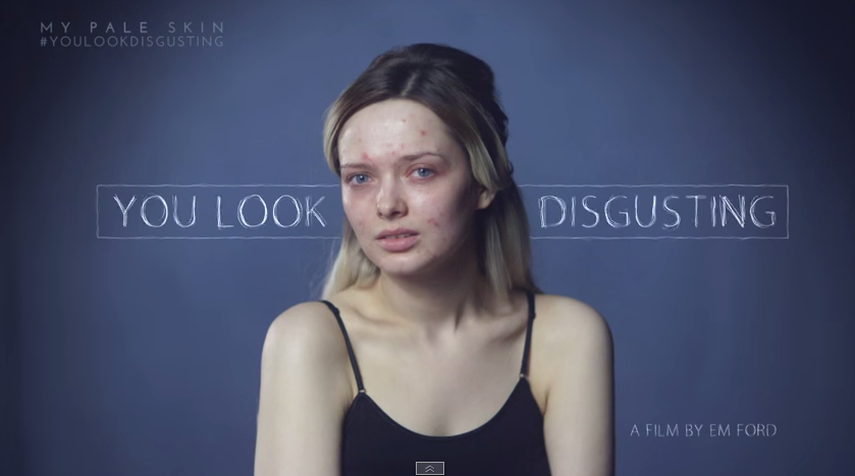 Em Ford sin maquillaje al principio de su video antibullying