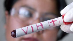El organismo internacional contabilizó en 2015 que en América Latina había 2 millones de personas con VIH, 100.000 nuevos contagios en adultos y 2.100 nuevas infecciones en niños.