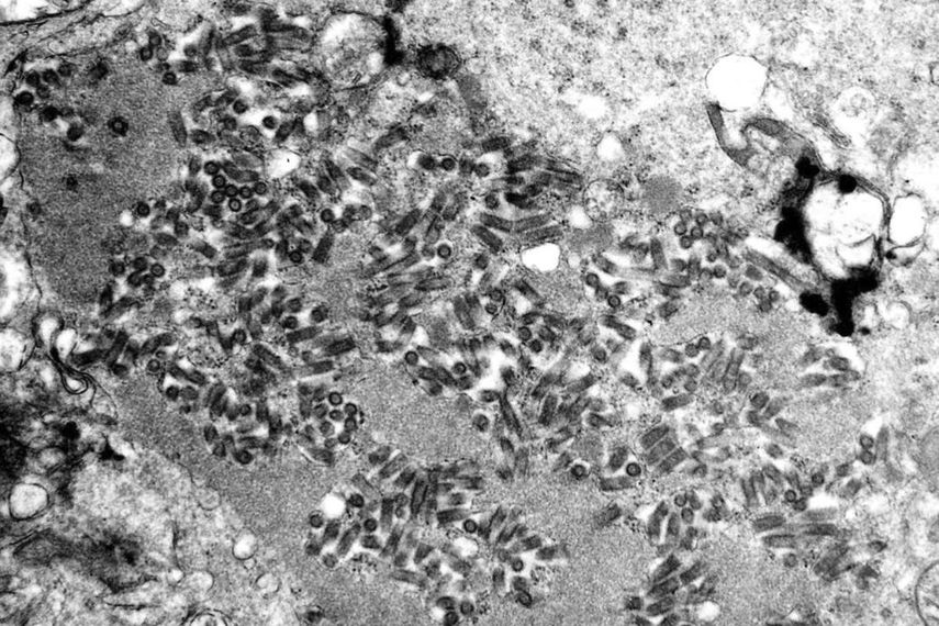 Imagen de un telescopio electrónico, proporcionada por los Centros para el Control y la Prevención de Enfermedades de Estados Unidos, muestra virus de la rabia, oscuros y en forma de bala, dentro de una muestra de tejido infectado.